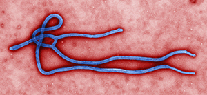 Ebola_virus_virion.jpg