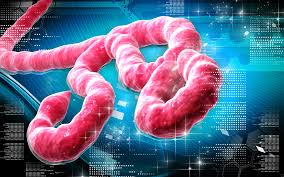 ebola